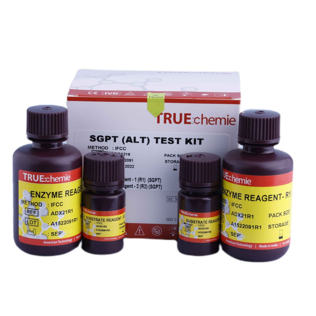 ADX216 TRUEchemie ALT (SGPT) TEST KIT - Clinical Biochemistry Kits - www.athenesedx.com